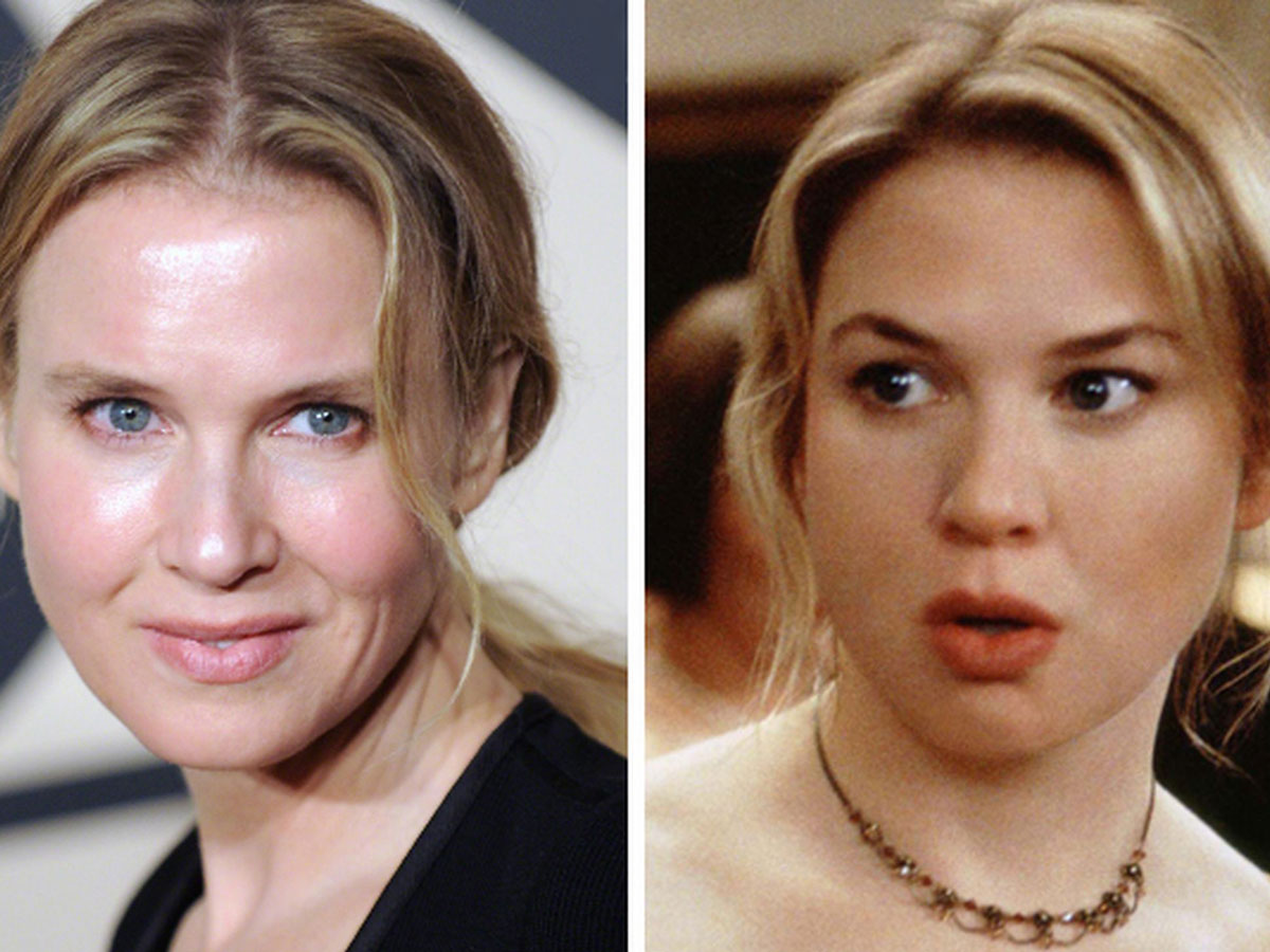 Renee Zellweger: before and after
